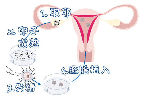 生殖科主任